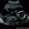 حامل 1 (gfyptm9bd3)